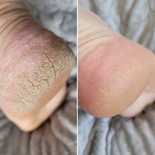 Ayşe Y. · ✓ Doğrulanmış müşteri fotoğrafı